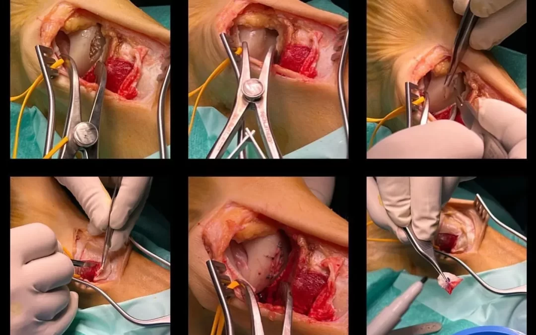 ¿Qué es un implante de cartílago?