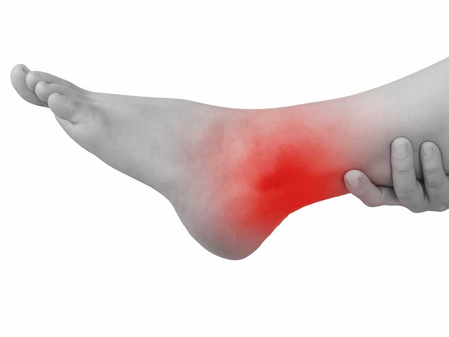 Osteocondritis del astrágalo: causas, síntomas y tratamiento