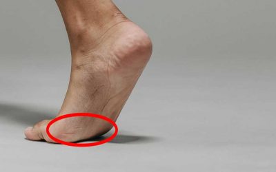 Dolor en el antepié: causas y cuándo acudir al traumatólogo