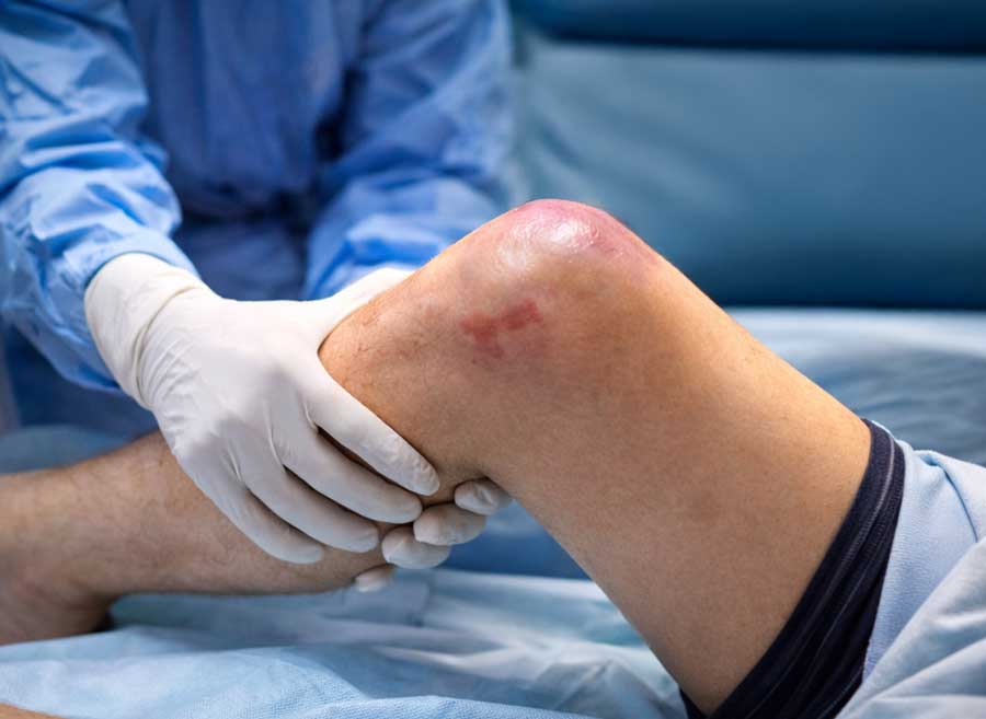 luxacion-de-rodilla-tratamiento-madrid