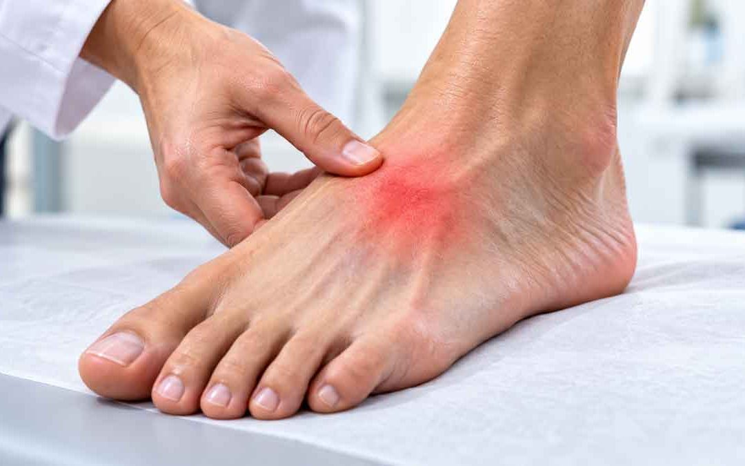 ¿Esguince de pie o lesión de Lisfranc? Qué no debes ignorar