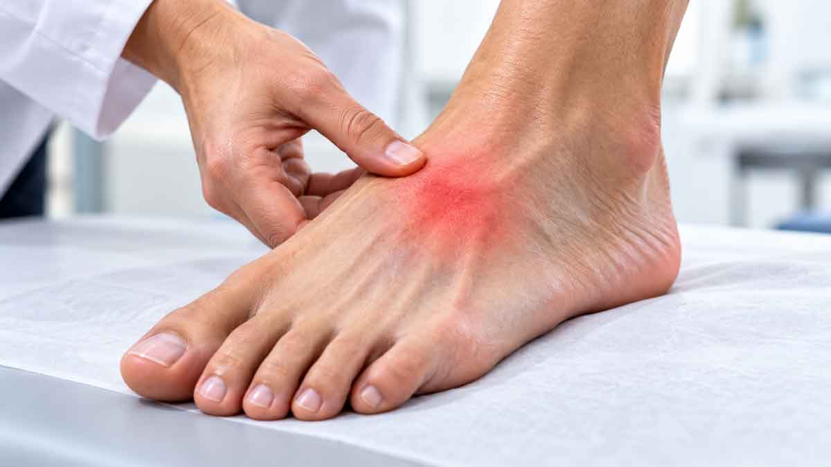 ¿Esguince de pie o lesión de Lisfranc? Qué no debes ignorar