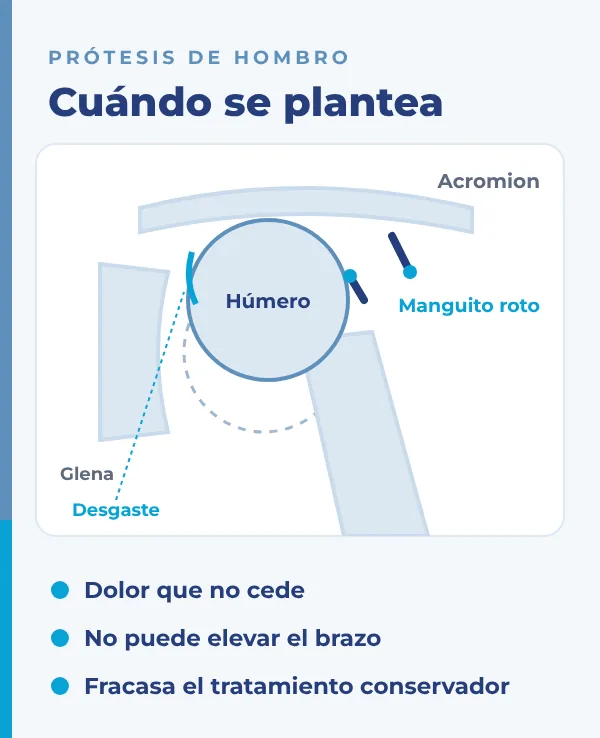 protesis-de-hombro-artropatia-manguito-rotador-dr-david-cimas